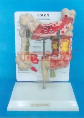 WEST DESK TYPE COMMON PATHOLOGIES OF COLON MODEL WITH DESCRIPTION PLATE